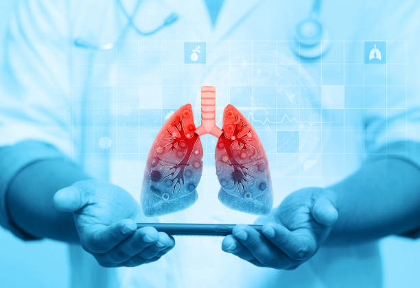 The Importance of a Pulmonologist: Navigating Lung Conditions with Expertise post thumbnail image