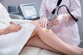 Unleash Your Confidence: Discover the Benefits of Laser Hair Removal post thumbnail image